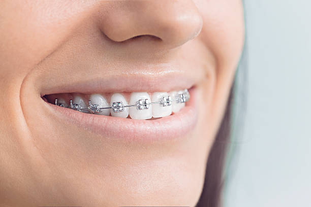 Best Wisdom Tooth Removal  in Rankin, TX